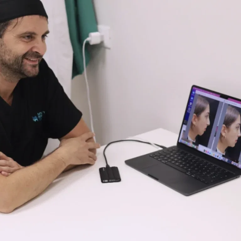 Il percorso completo per una Rinoplastica di successo con MyRhinoPlastyDoc