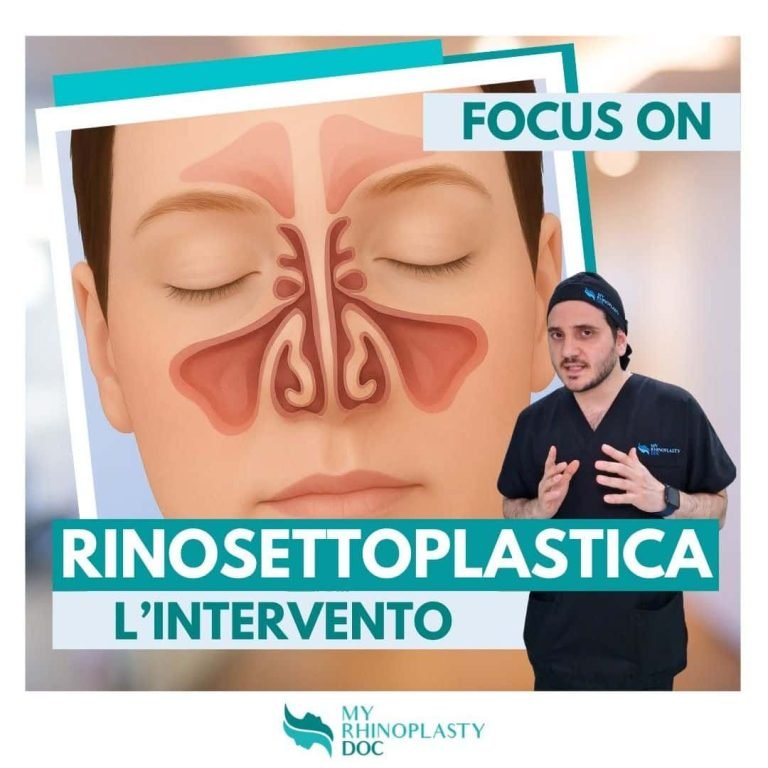 Rinosettoplastica quali problemi respiratori può risolvere