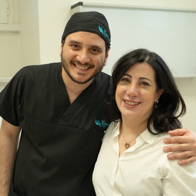 come la Rinosettoplastica ha trasformato il respiro e il profilo di Marcella