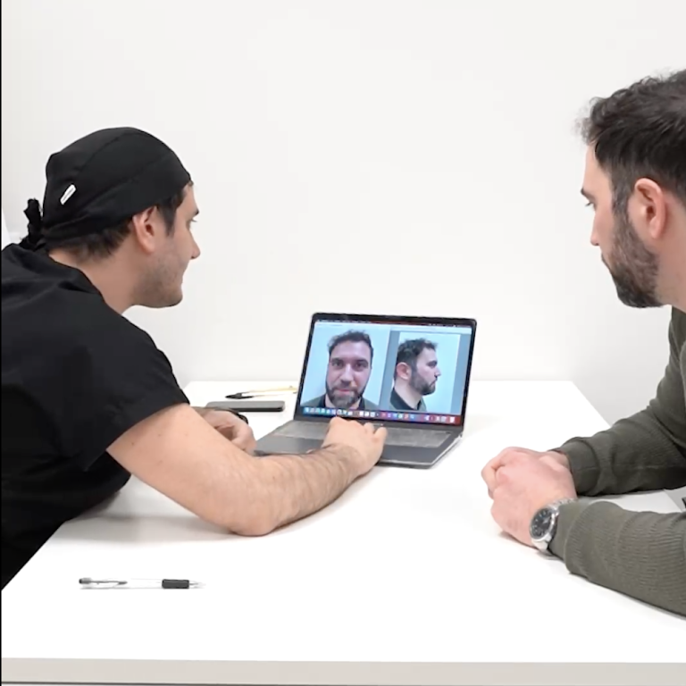 la prima visita di rinoplastica con myrhinoplastydoc